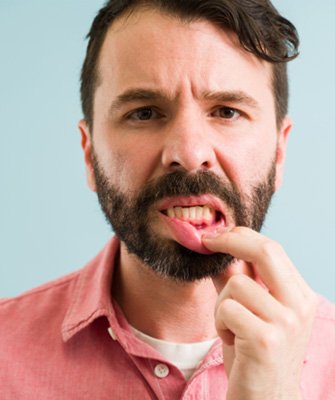 concerned man showing his gums 