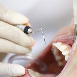 periodontal exam
