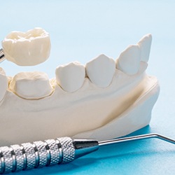 prosthetic dental crown on a model of teeth