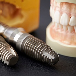 implant dentures in Westhampton (for the Are Implant Dentures More Expensive section)