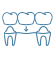 Dental implant bridge icon highlighted