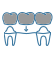 Dental implant bridge icon