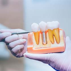 dentist answering questions about dental implants in Westhampton