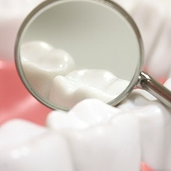 Closeup of teeth during dental exam