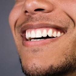 man smiling teeth