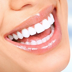 Closeup of brilliant white smile