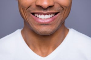 man smiling after a smile makeover